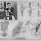 Illustration for article titled The First Hair Plug Machine Looks Absolutely Horrifying